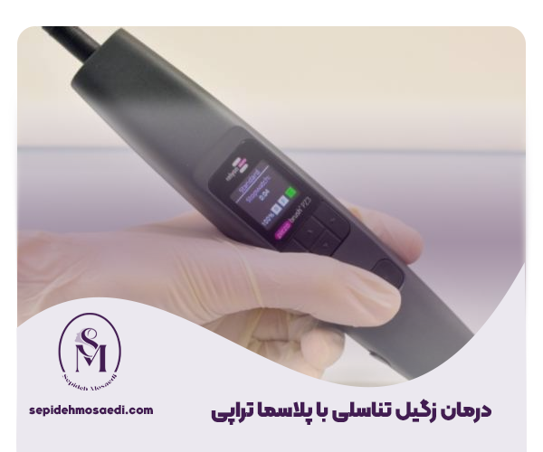 درمان زگیل تناسلی با پلاسماتراپی؛ بدون جراحی و درد! 1 درمان زگیل تناسلی با پلاسما تراپی