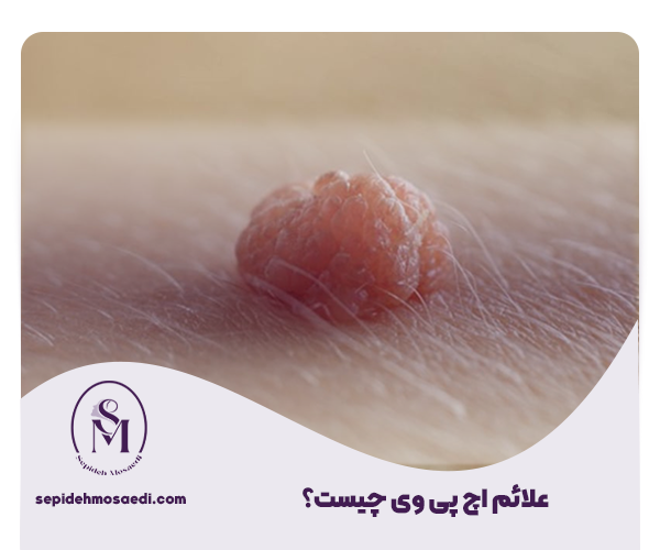 در صورت دارا بودن علائم اچ پی وی چه کنیم؟ مراحل تشخیص تا درمان 1 علائم اچ پی وی چیست