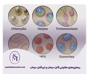 وبلاگ 4 بیماری های مقاربتی