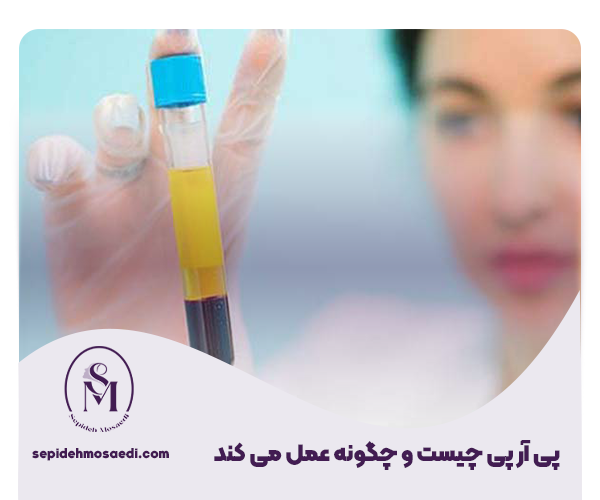 پی آر پی واژن چیست؟ راهنمای جامع بررسی PRP 1 پی ار پی بیکینی چیست؟