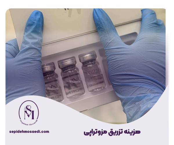سفید کردن واژن با مزوتراپی واژن؛ تجربه، هزینه و نتایج 3 هزینه تزریق مزوتراپی واژن
