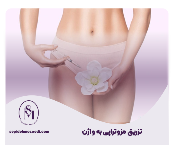 مزوتراپی واژن