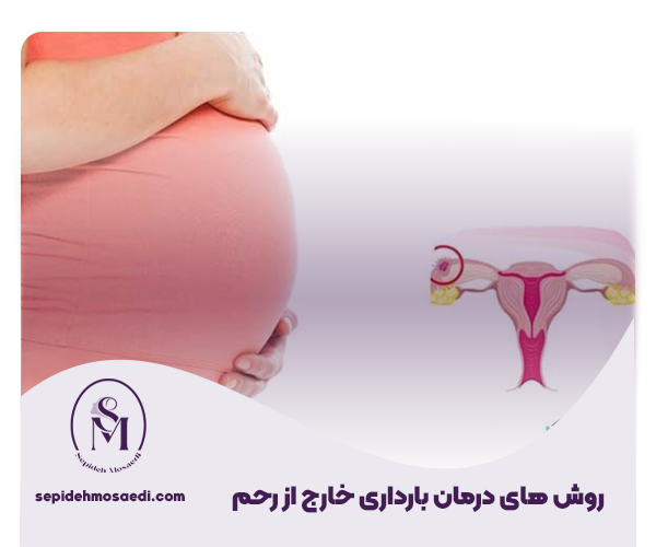 بارداری خارج از رحم و همه چیز درباره آن 2 روش های درمان بارداری خارج از رحم23