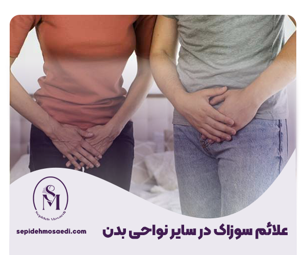 بیماری سوزاک و راههای درمان آن؛ راهنمای جامع و کامل 2 علائم سوزاک در سایر نواحی بدن21