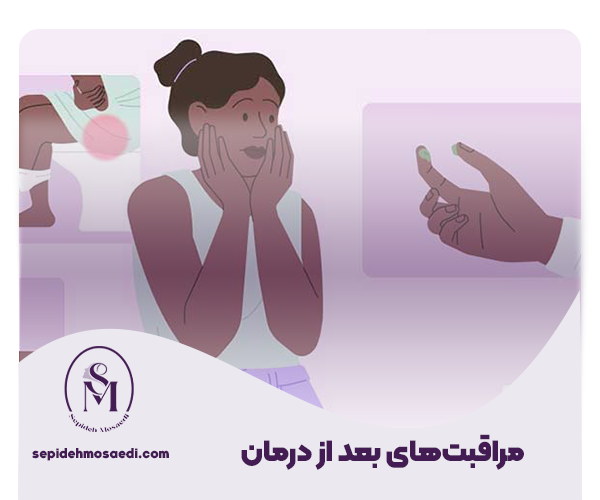 بیماری سوزاک و راههای درمان آن؛ راهنمای جامع و کامل 3 مراقبتهای بعد از درمان21