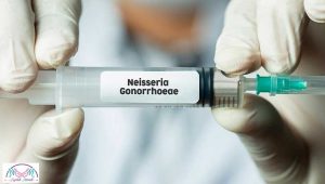 Gonorrhea 2