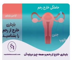 بارداری خارج از رحم چیست