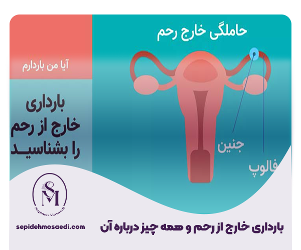 بارداری خارج از رحم چیست