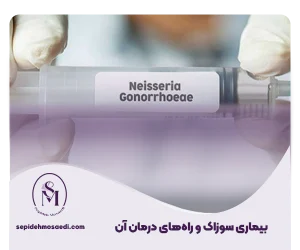 را ه درمان بیماری سوزاک