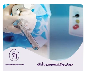 درمان واژینیسموس