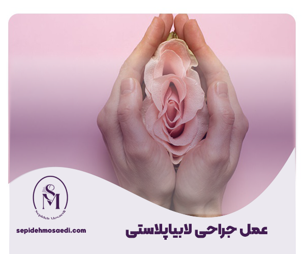 جراحی لابیاپلاستی
