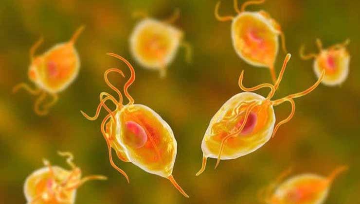 Trichomoniasis 