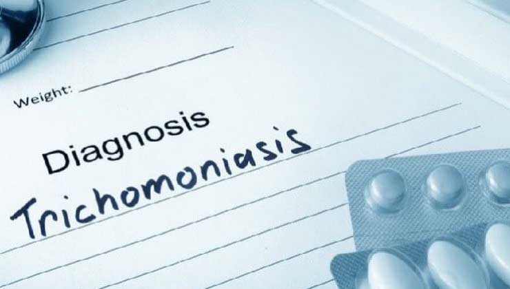 Trichomoniasis