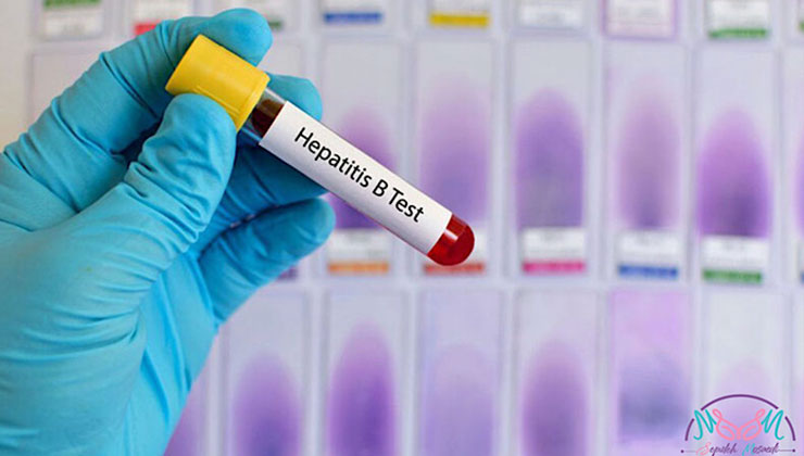 hepatitis b