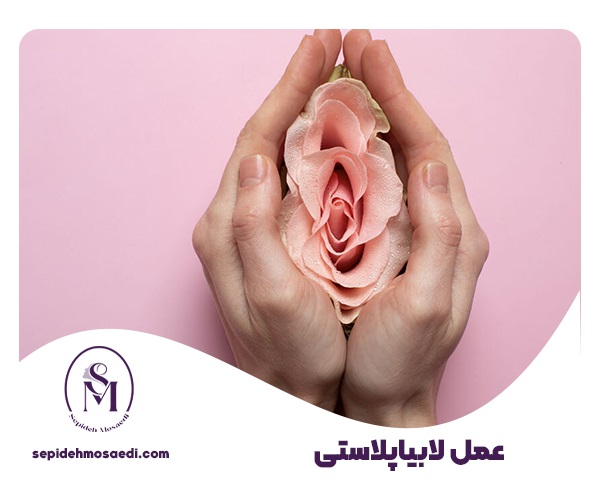 عمل لابیاپلاستی