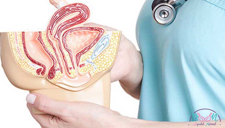 laser vaginoplasty