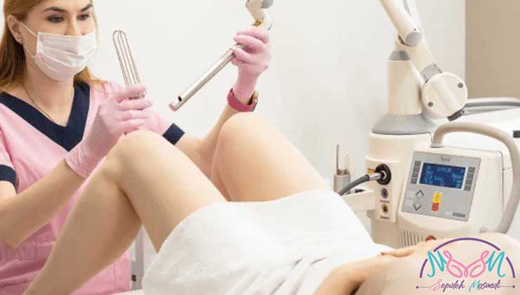 laser vaginoplasty 2