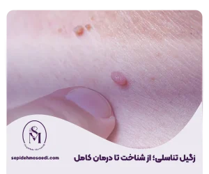 چگونگی شناخت اچ پی وی