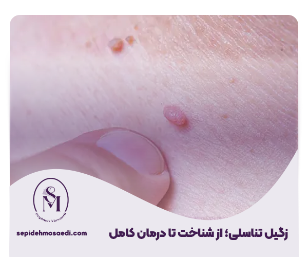 چگونگی شناخت اچ پی وی