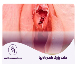 علت بزرگ شدن لابیا - روش های درمان بزرگ شدن لبه های واژن