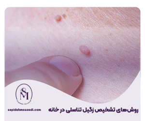 وبلاگ 15 روش تشخیص زگیل تناسلی در خانه