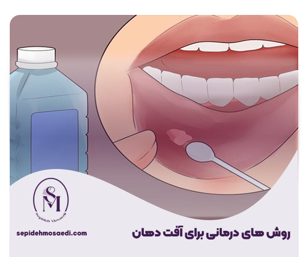 تفاوت آفت دهان با زگیل دهانی 3 1 روش های درمانی برای آفت دهان