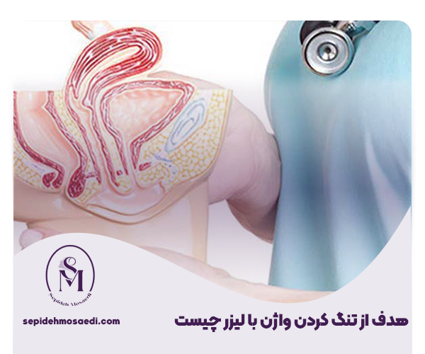 عکس عمل زیبایی واژن با لیزر