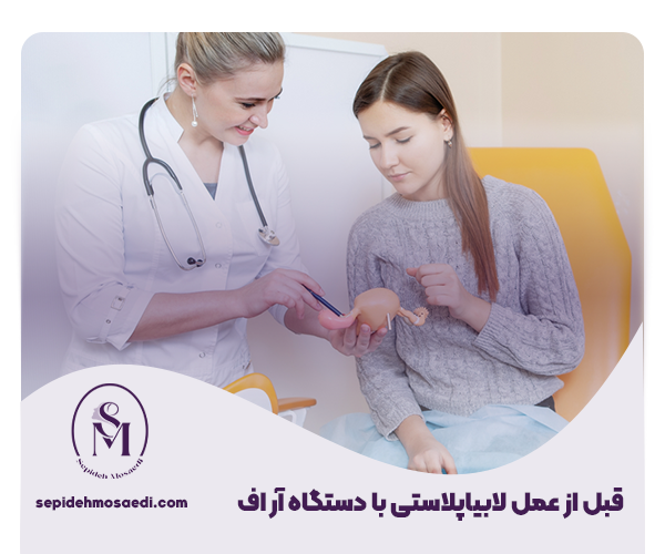 لابیاپلاستی با آر اف چگونه انجام می شود؟ - مزایای لابیاپلاستی با RF 3 4 نکات مراقبتی قبل از عمل لابیاپلاستی با دستگاه آر اف