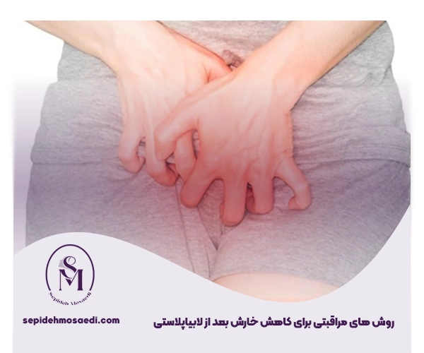 علت خارش بعد از عمل لابیاپلاستی چیست؟ 3 روش های مراقبتی برای خارش بعد از لابیاپلاستی