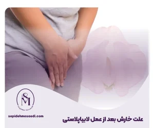 Itching after labiaplasty