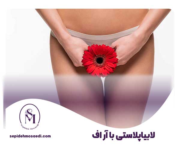 لابیاپلاستی با آر اف