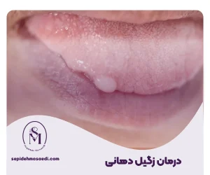 Oral Wart Treatment