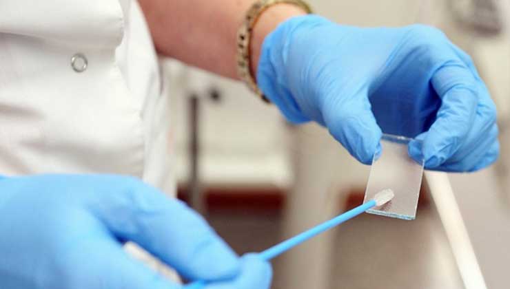 Women's screening tests