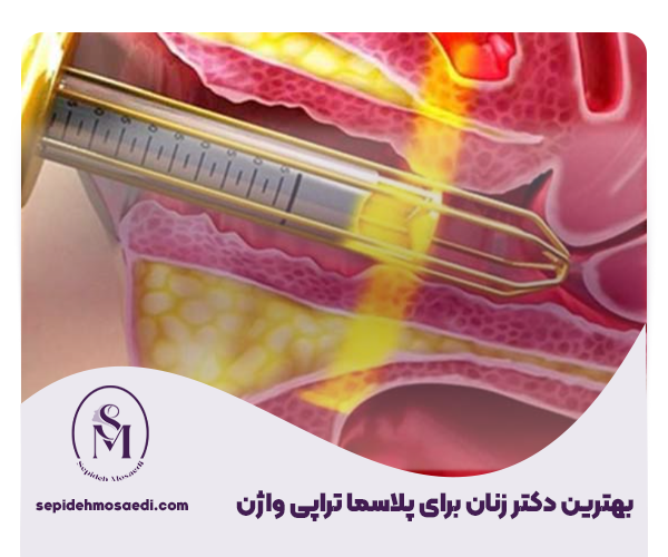 تنگ کردن واژن با لیزر (واژینوپلاستی با لیزر): بررسی هزینه، ماندگاری و تعداد جلسات 7 تجربه تنگی واژن با لیزر