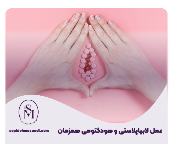 Labiaplasty and hydectomy at the same time