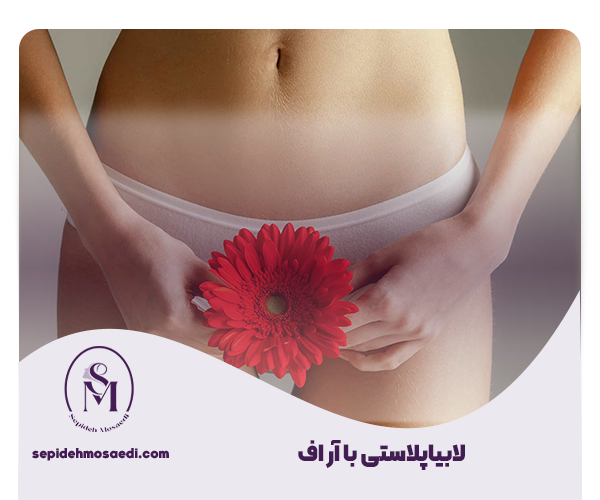 لابیاپلاستی با آر اف