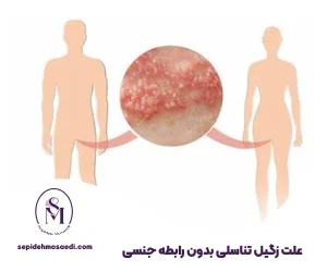 وبلاگ 12 زگیل تناسلی بدون رابطه