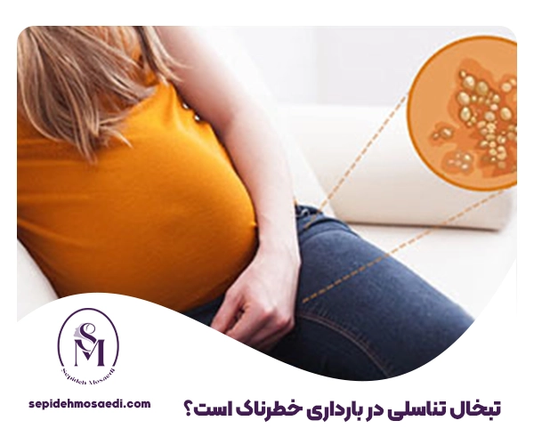 تبخال تناسلی در بارداری