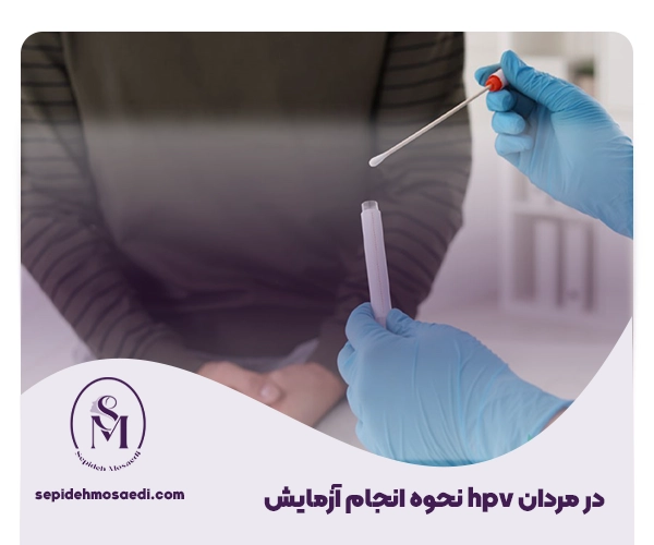 آزمایش HPV در مردان چیست و چگونه انجام می شود؟ 1 تست اچ پی وی در مردان
