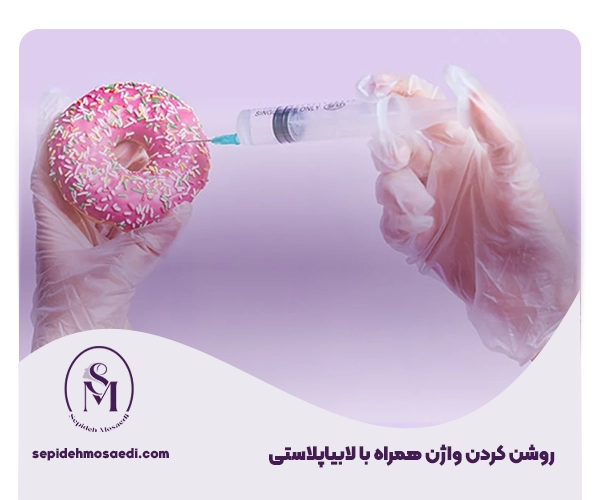 جراحی لابیاپلاستی همزمان با وایتنینگ 1 Labiaplasty surgery at the same time as whitening