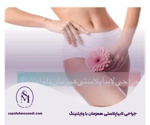 وبلاگ 4 لابیاپلاستی همزمان با وایتنینگ