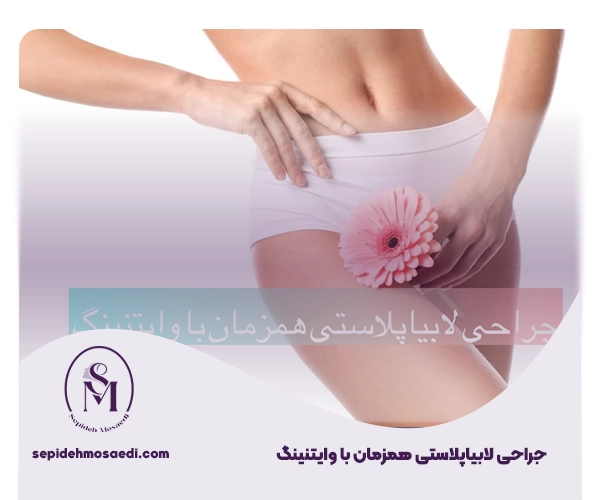 لابیاپلاستی همزمان با وایتنینگ