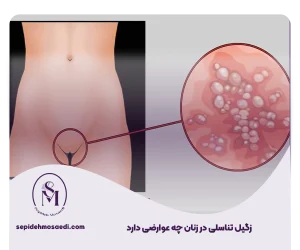 وبلاگ 8 عوارض زگیل تناسلی در زنان