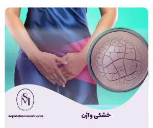 وبلاگ 17 خشکی واژن