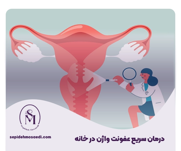 درمان عفونت واژن در خانه 2 درمان عفونت قارچی واژن در خانه
