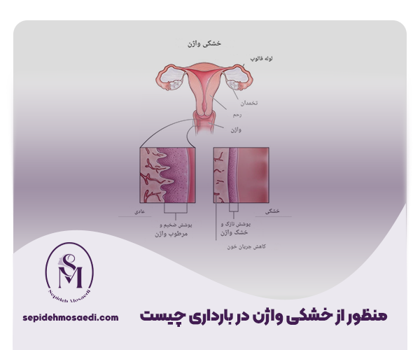 درمان خشکی واژن در بارداری 1 منظور از خشکی واژن در بارداری چیست