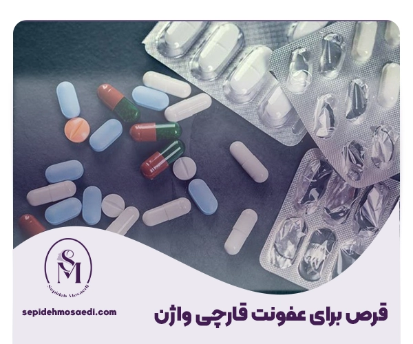 قرص برای عفونت واژن