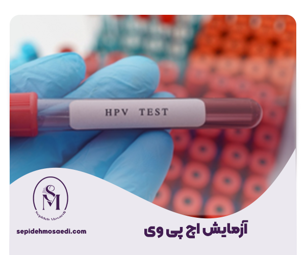 آزمایش hpv