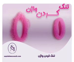 تنگ کردن واژن