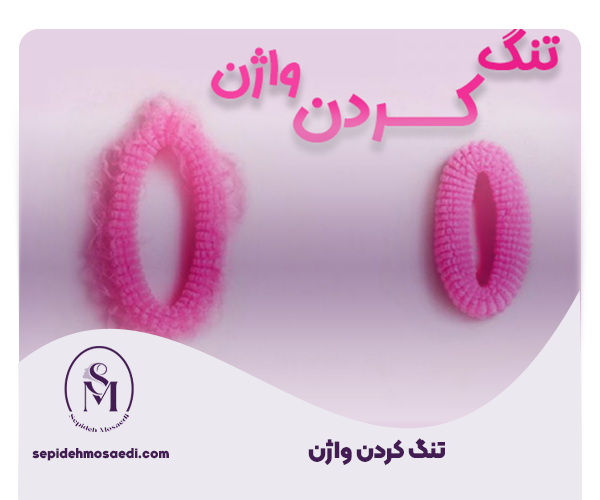 تنگ کردن واژن